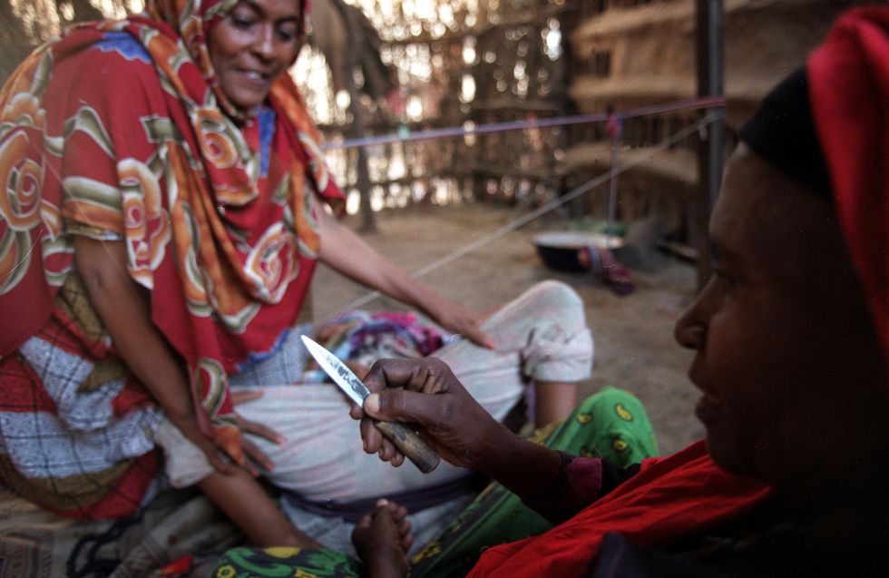 Una curandera somalí muestra los instrumentos para la mutilación genital de una niña.Bernardo Pérez